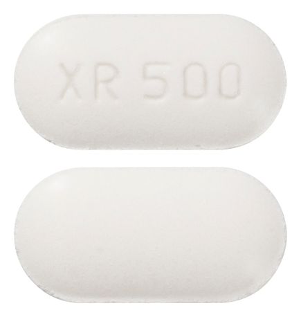 view of Metex XR